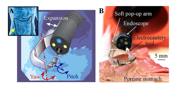 Endoscopic_Surgery2.jpg