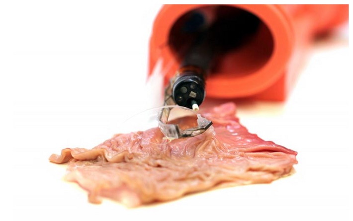 Endoscopic_Surgery3.jpg