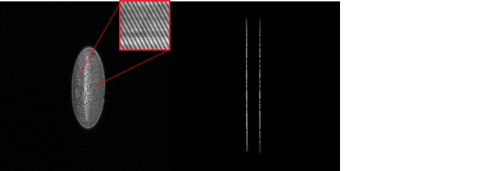 laser_fig2.jpg