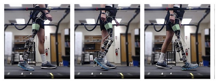 Prosthetics.jpg