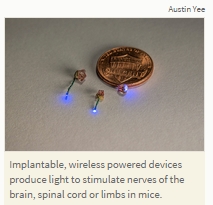 implantable_device2.jpg